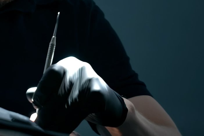 Tandläkarens hand i svart handske med sond och spegel under en undersökning.